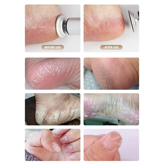 2-in-1 Electric Foot Callus Remover, USB Rechargeable with 3 Modes, 3 Size Sanding Discs & Cylinder, Battery Display, Cordless Aluminum Foot/Nail/Dead Skin Tool, Silver.